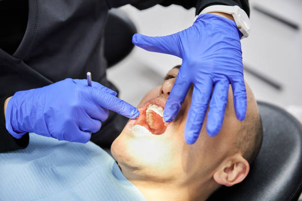 Best Emergency Gum Treatment in Utica, SC